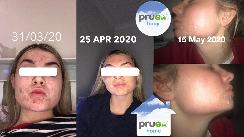 Nature has the ingredients to help skin