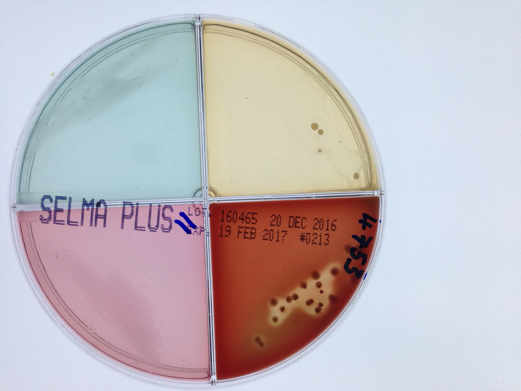 How clean is your kitchen?